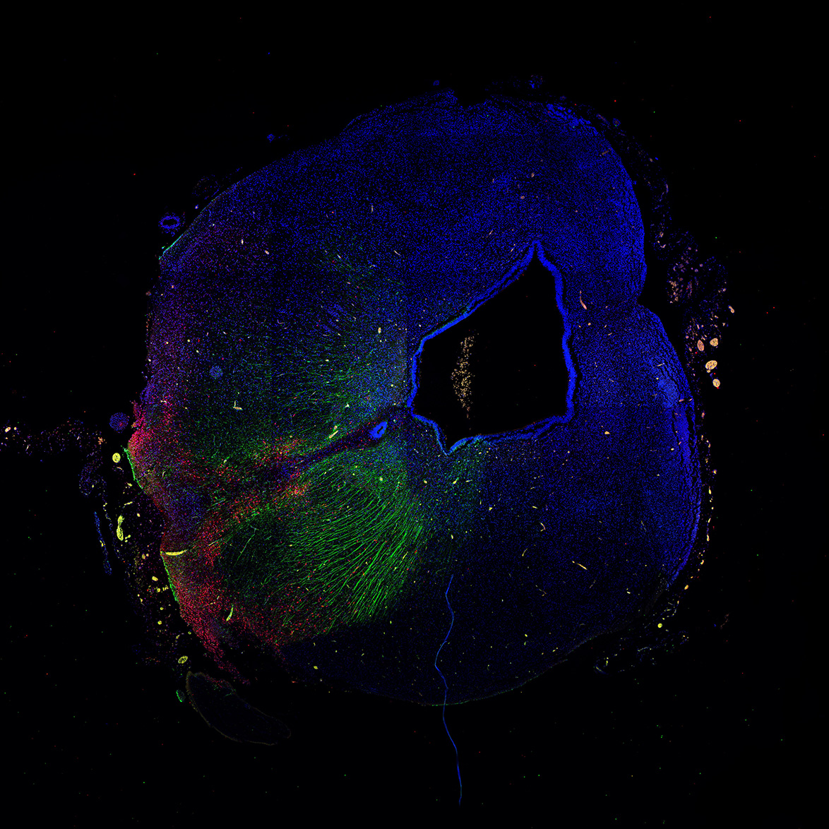 Human foetal midbrain